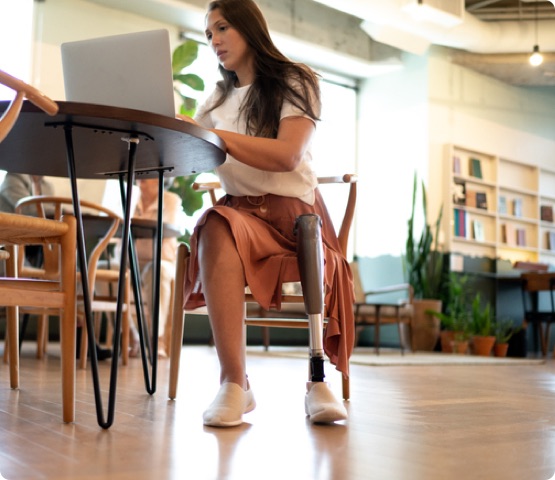 Disabled amputee person using laptop at office